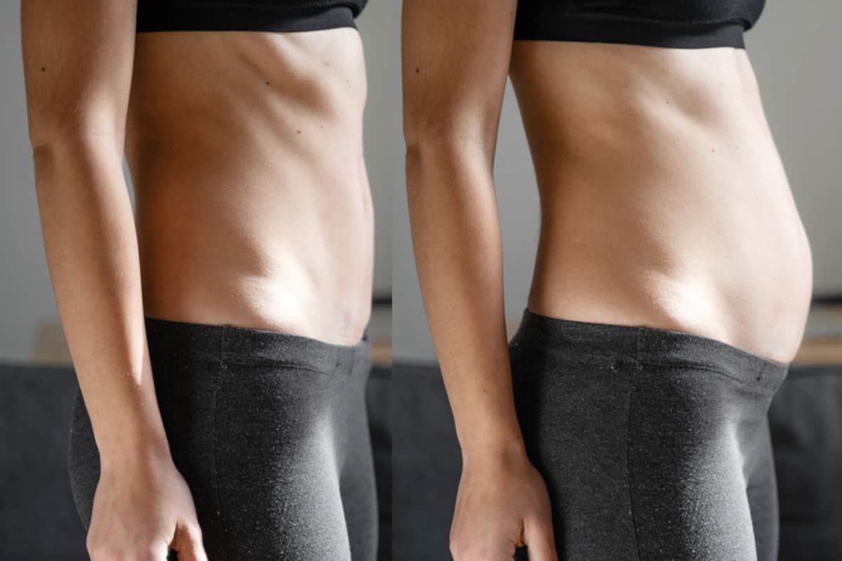 How long does diastasis recti take to improve Hampton Wick?