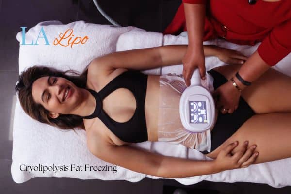 woman getting cryolipolysis Hampton Wick