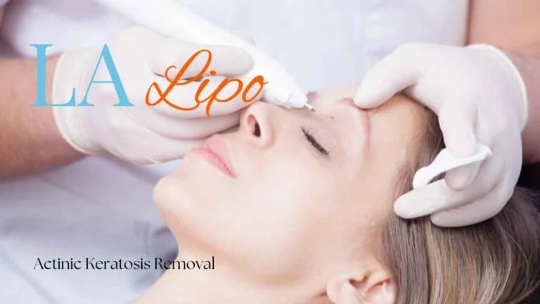 Woman receiving Actinic Keratosis Removal Treatment Hampton Wick