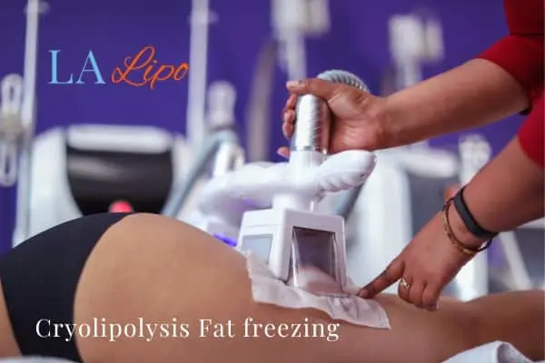 women getting fat freezing Hampton Wick