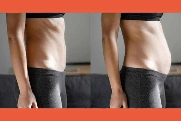 LA-EMS Body Sculpting results Hampton Wick