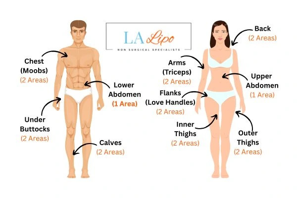LA LIPO Cryolipolysis Areas Hampton Wick