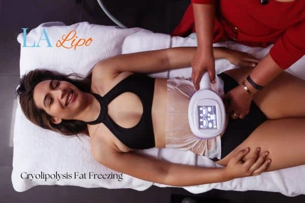 woman getting cryolipolysis Hampton Wick