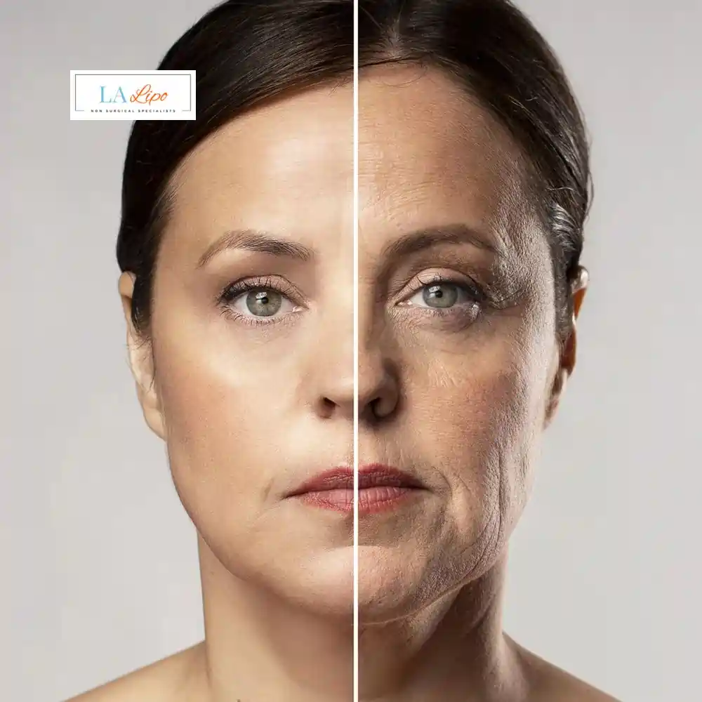 How Can You Tell If Non-Surgical Skin Tightening Is Right for You Hampton Wick?