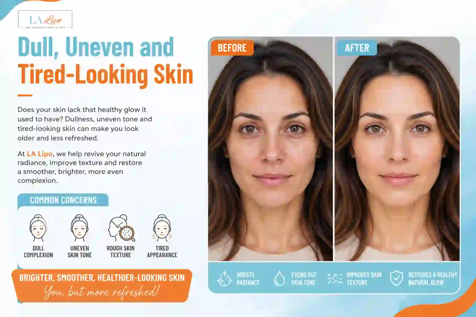 Sign #5: Dull, Uneven and Tired-Looking Skin Hampton Wick