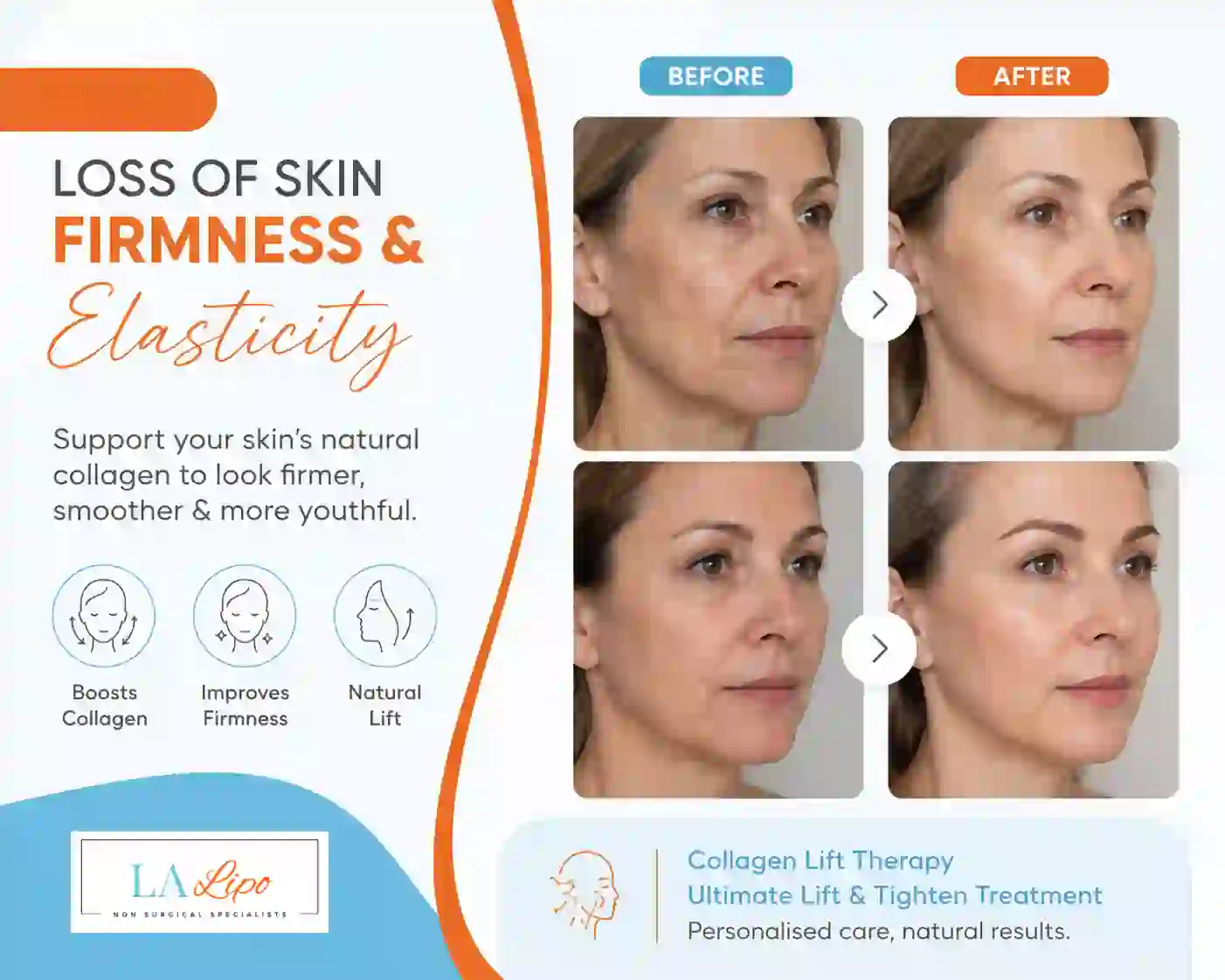 Sign #7: Loss of Skin Firmness and Elasticity Hampton Wick