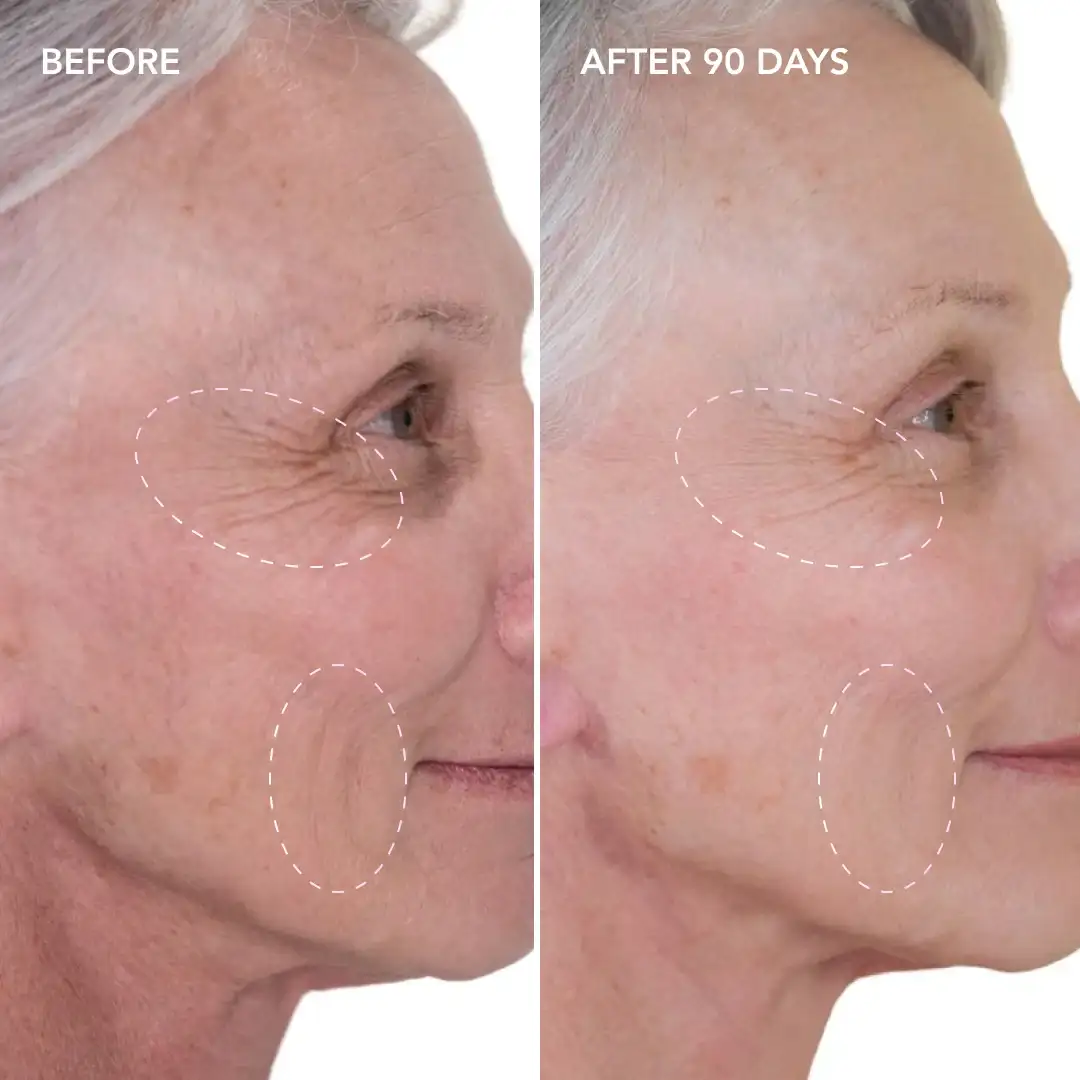 When will you see results Hampton Wick